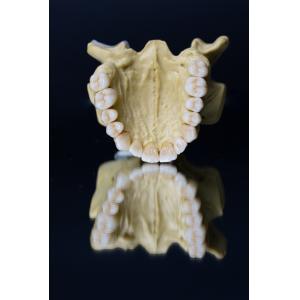 Dental Lab Porcelain Zirconia Dental Crown 5 Stars Esthetics