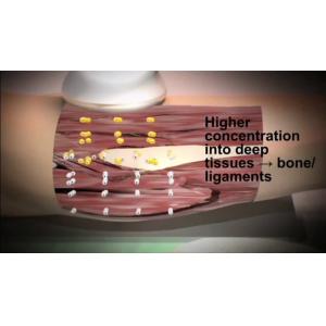 LCD ディスプレイ Physio Tecar Indiba Diathermy Machine Cet Ret 448khz