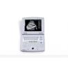 Mobile Ultrasound Machine Digital Laptop Ultrasound Scanner with 100 Frames