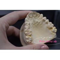 China Customizable Modern Dental Inlay And Onlay Versatile Applications on sale