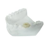 China Durable FDA All-Ceramic Dental Crown Veneer Inlay Onlay Similar on sale