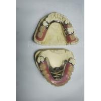 China PEEK Upper Removable Partial Denture Requires Regular Maintenance on sale