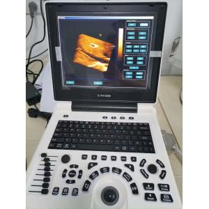 Xianfeng Pregnancy Color Doppler Ultrasound Machines Images 4B OEM