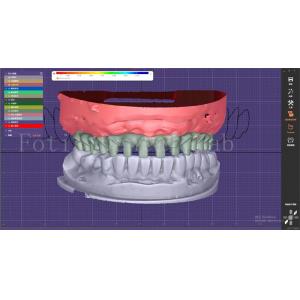 OEM Mouth Models Maker Dental Design Service With Tooth Blueprint Builder
