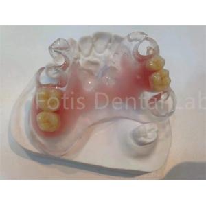 Hypoallergenic Stain Resistant TCS Valplast Dental Prosthetics For Long Lasting Comfort