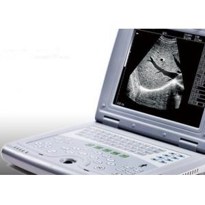 China Portable Ultrasound Machine for Pregnancy Portable Ultrasound Scanner Only 2.2kgs Weight supplier