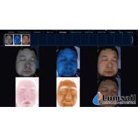 China Portable Skin Analysis Machine Skin Testing Machine For Face Enhanced / Rejuvenation on sale