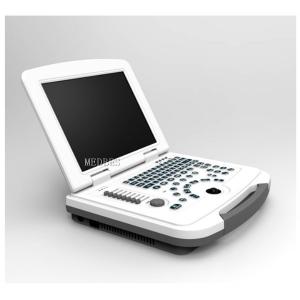 Clinic Hospital  Obstetrics and Gynecology Department Laptop Ultrasound Machine with Battery