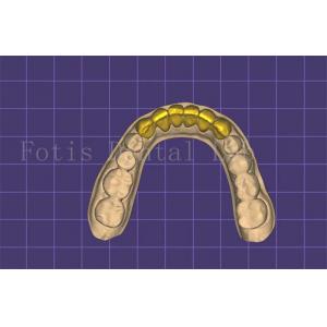 Customizable Dental Mouth Model Maker Autoclavable FDA Approved