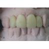 China High Translucency White Stone Model Diagnostic Wax Up With Tooth Model For Teeth Cosmetic wholesale