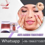 Hyamely Botox Injection 100 Unit Anti Wrinkles