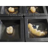 China Dental Restorations Zirconia Multilayer Fracture Resistance on sale