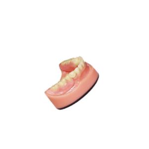 Denture Dental lab PFM Dental Bridge 3D Digital Intraoral Scanning Imaging System