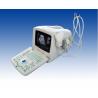 China 12 Inch LED Screen Portable Digital Ultrasound Scanner with All Kinds of Probes wholesale