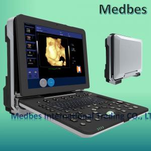 China Hospital 3D Fetal doppler Ultrasound Scanner Ultrasound Machine supplier