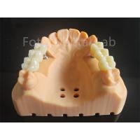 China Customized Full Contour Zirconia Layered With Porcelain Dental Material on sale