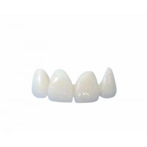 China Easy Cleaning All Ceramic Crowns Transparent Natural Shade Customizable supplier