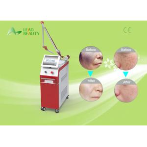 Q-switch nd yag laser tattoo removal machine with professional technology