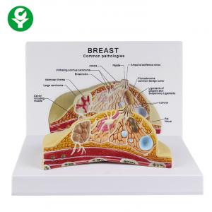 Female Cross Section Breast Cancer Model Anatomical 1.0 Kg Single Gross Weight