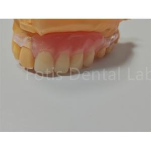 FDA/ISO Certification TCS Valplast Flexible Dentures Easy To Clean Adjust