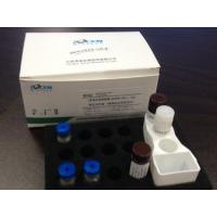 China ST2 IVD Products For Automatic Immunoassay Analyzer In Cardiac Marker on sale