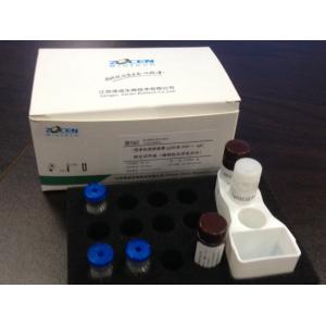China Diagnóstico de diagnóstico clínico de Kit Tumor Maker Assay For do teste de Glycopro da transmembrana de Golgi do câncer do fígado (GP73) in vitro supplier