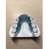 China Adjustable Retainer Palate Expander Safe Comfortable Teeth Retention Solution on sale