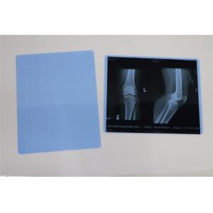 China High Definition 8*10 Inch Dry Imaging Film Agfa 5302 Printer Medical Xray Film supplier