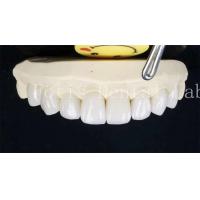 China 0.3-0.5mm Ceramic Laminate Teeth False Teeth Veneers With Adhesive Bonding Cement on sale