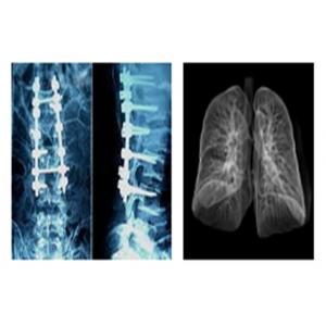 China Sharp Radiographic Medical X Ray Films , Mri Dr Ct Digital Dry Imaging Film supplier