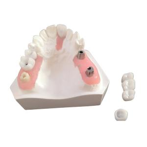 Good Biological Inter Miscibility Dental Implant Bar With FDA Approval