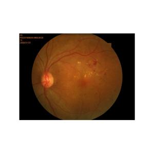 China SYSEYE RetiCam 3100 Digital Fundus Camera with 1.3 Magnification 26.5Kg Weight and 90 mm Stage Movement for High Precision Retinal Imaging wholesale