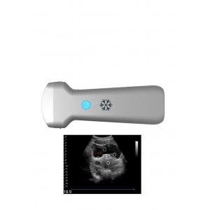 Ultrasonication Convex Wireless Ultrasound Probe For Gynecology