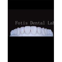China High Translucency Porcelain Tooth Veneers Enhance Your Smile Naturally on sale