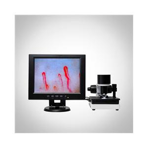 China LCD Display Health Analyzer Machine Clinical Blood Analysis Microcirculation Microscope supplier