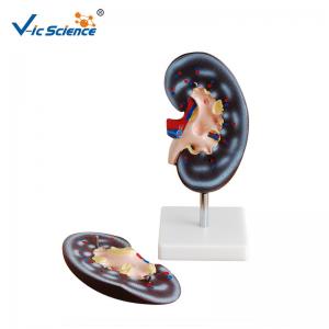 China Medical Human Anatomical Model Plastic Kidney Anatomy Model 2 Parts VIC-310-2 supplier