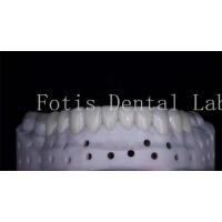 China OEM ODM Stain Resistant Natural Looking Porcelain Veneers High Strength on sale