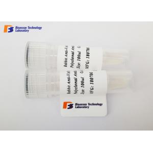 Neuron Specific Enolase Mouse Monoclonal Antibodies CE / ISO / MSDS Approved