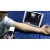 China Wireless Linear Probe High Frequency Probe Special Tool for Visual Puncture Guidance Integrated Handheld Ultrasound Scanner wholesale