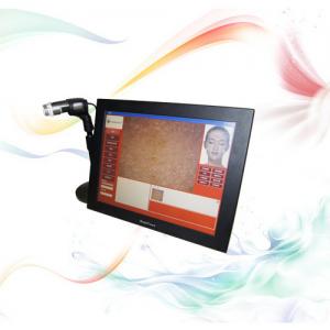 China 10Mhz Body Skin Analyzer Machine , Sensitivity Skin Analyzer supplier