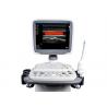 Compact / Agile Trolley Colour Doppler 3D 4D Ultrasound Machine For Pregnancy