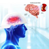 China 810nm Light Therapy Machine Neurofeedback Therapy Machine Transcranial Magnetic Brain Stimulation on sale