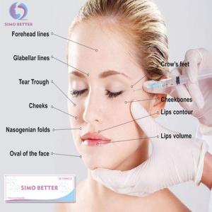 China Adult Hyaluronic Acid Fillers Cannula Long Lasting Injectable Lip Fillers supplier