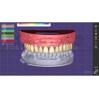 China Dental Teeth Design Service With Prosthesis Planning And Oral Implant Designs on sale