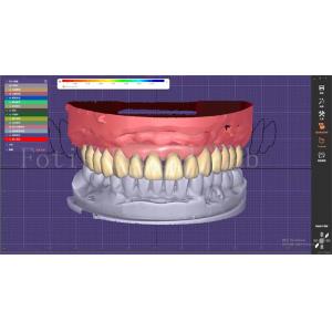 Dental Teeth Design Service With Prosthesis Planning And Oral Implant Designs