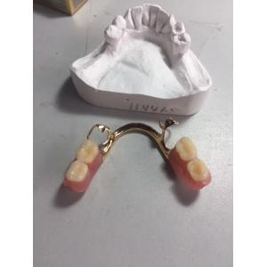 dental lab/dental/partial denture/partial/acrylic partial