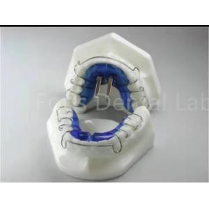 Orthodontic Treatment Retainer Expander For Precise Teeth Alignment