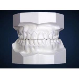 Dental Ortho Study Model Ekodent For Orthodontic Treatment