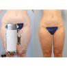 China Fat / Cellulite Reduction Power Assisted Slimming Beauty Equipment With Oil Free Vacuum Pump wholesale