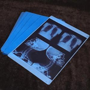 High Printing Inkjet X Ray Film Blue Film Thickness 210 Microns Blue Transparent
